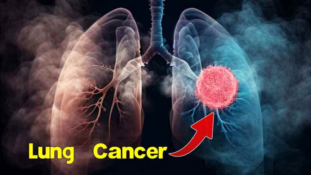 Why lung cancer more common in males