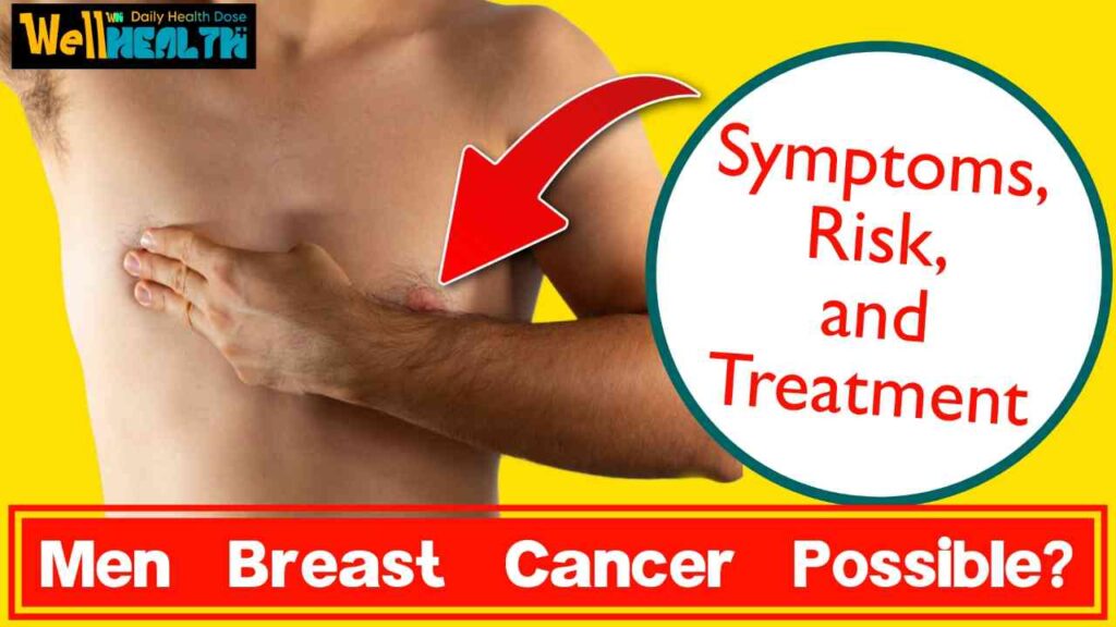 male breast cancer