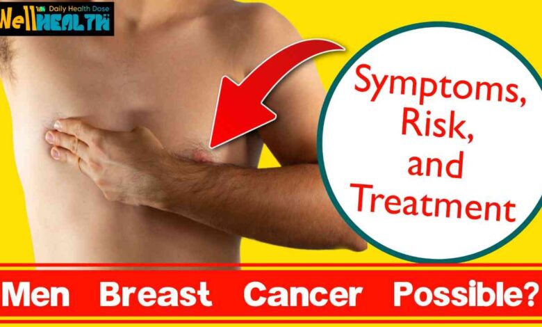 Male Breast Cancer